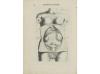 1681. LIBRO. (MEDICINA). MAURICEAU, FRANÇOIS:. TRAITE DES MA