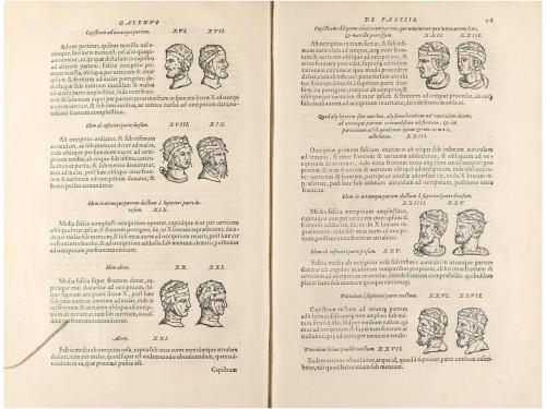 1555. LIBRO. (MEDICINA). [CHIRURGIA: DE CHIRURGIA SCRIPTORES